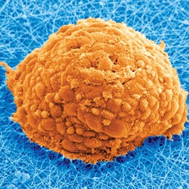 SEM image of a 3D induced pluripotent stem cell colony on an electrospun scaffold