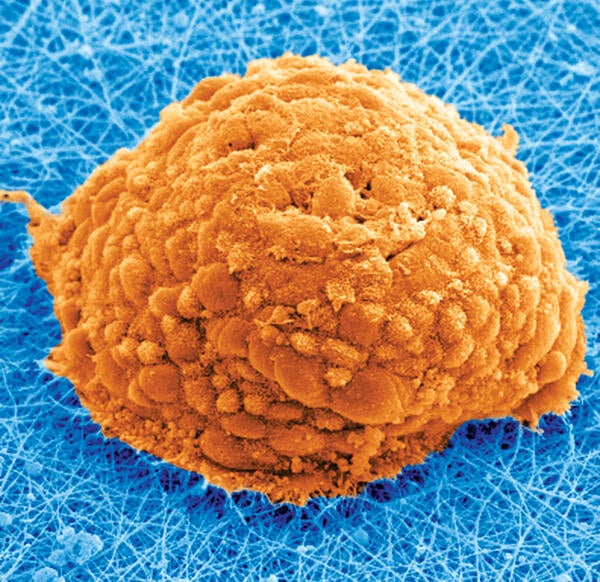 SEM image of a 3D induced pluripotent stem cell colony on an electrospun scaffold