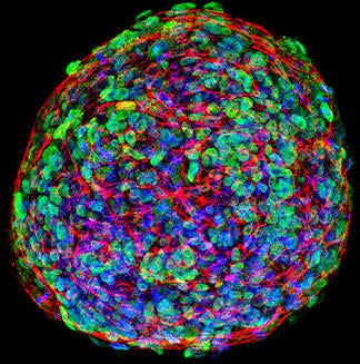 Confocal IF image of a 3D induced pluripotent stem cell colony on an electrospun scaffold